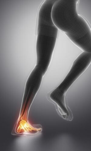 Achilles Tendinopathy are often chronic injuries
