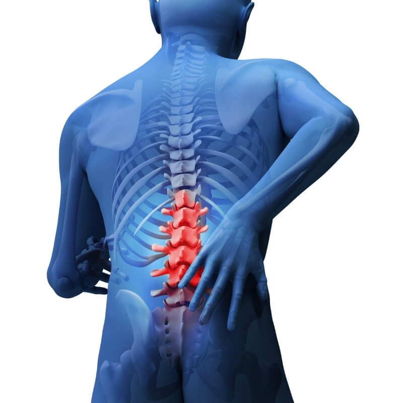 back pain disc bulge L4/5 L5/S1 lumbar spine benefit physiotherapy and rehabilitation clinic western sydney