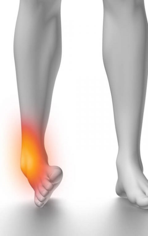 Ankle Sprains: Why They Occur and When To Seek Help - Benefit Physiotherapy